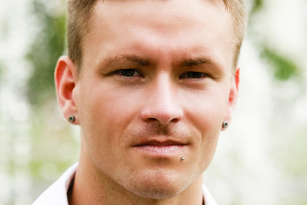 Labrety u mężczyzny